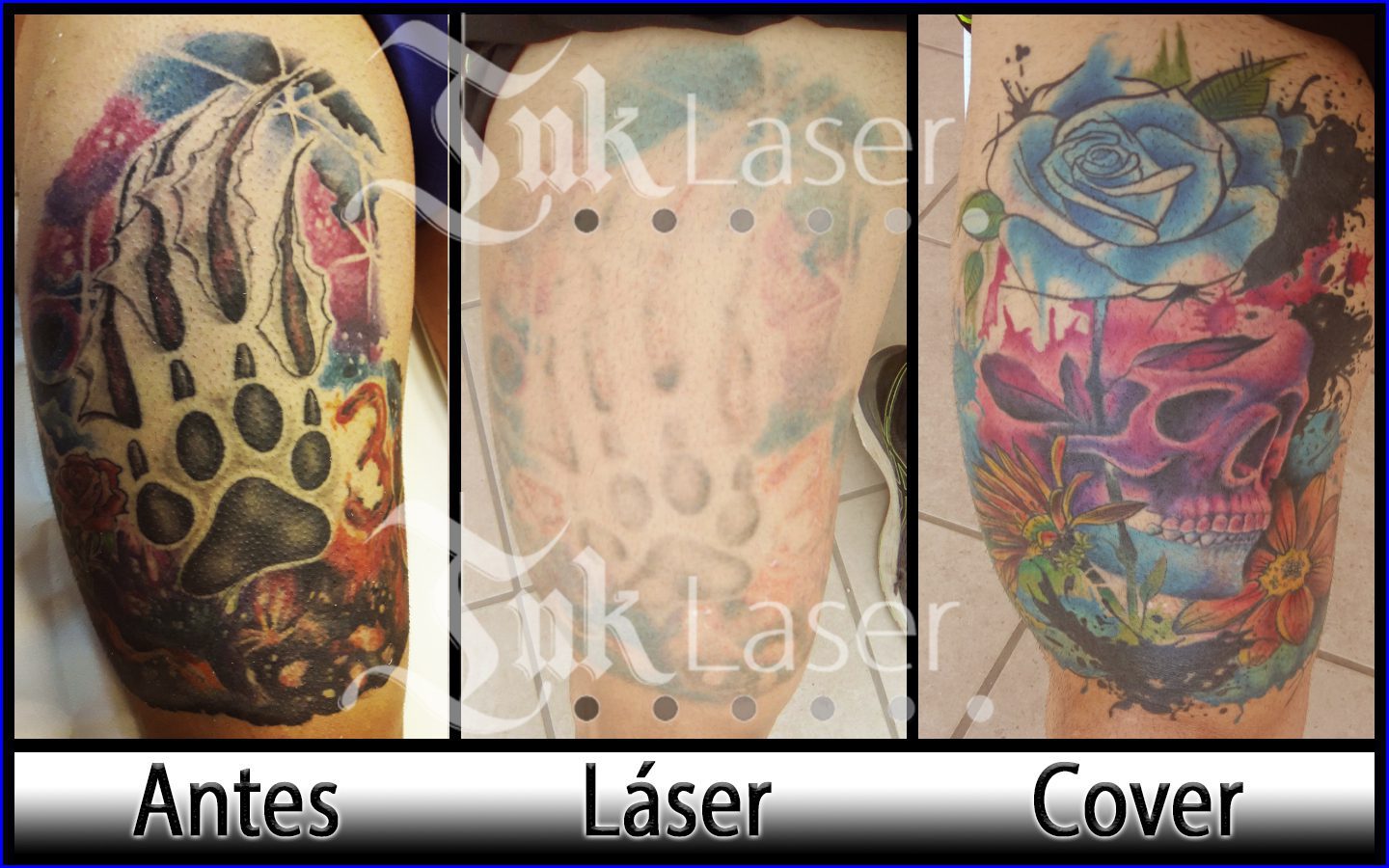 Cover tattoo Alicante