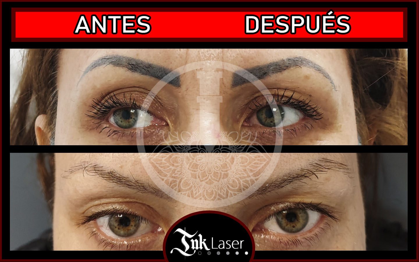 Cada cuanto tiempo se hacen las sesiones de quitar microblading