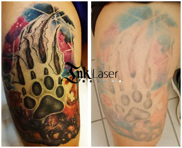 Cómo queda la piel después de quitarse un tatuaje