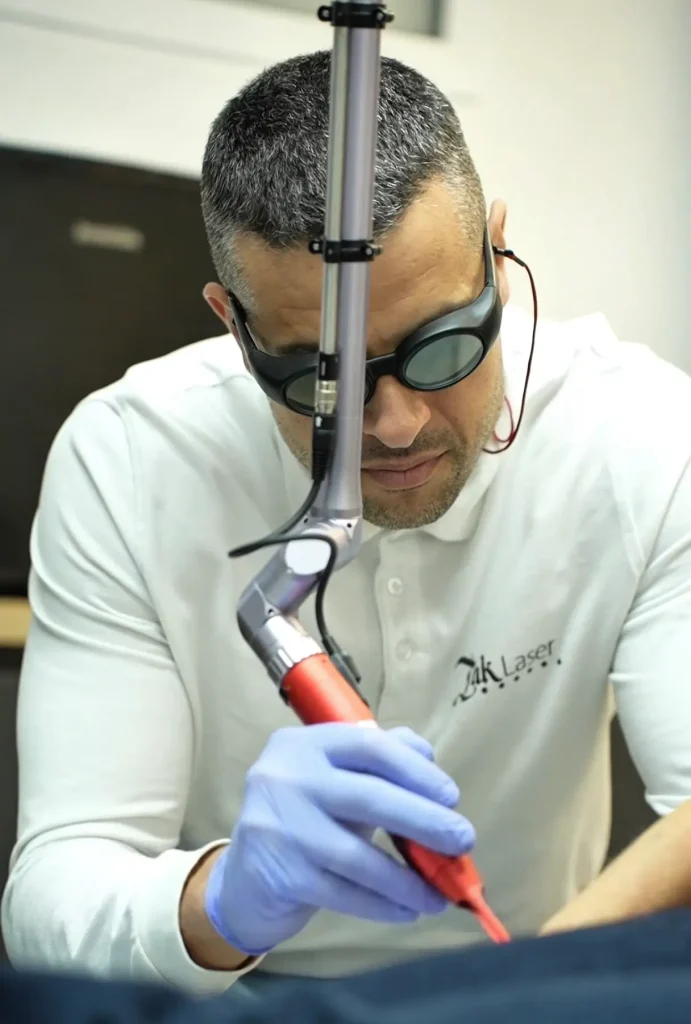 Eliminación de microblading